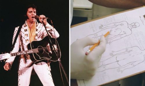 Elvis Presley’s autopsy: Inconsistencies over rock and roll legend’s ...